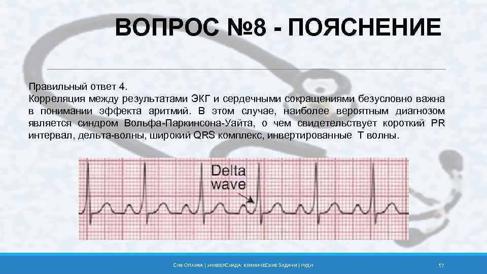 ВОПРОС № 8 - ПОЯСНЕНИЕ Правильный ответ 4. Корреляция между результатами ЭКГ и сердечными