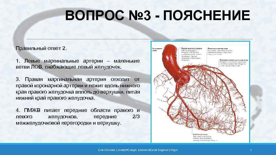 ВОПРОС № 3 - ПОЯСНЕНИЕ Правильный ответ 2. 1. Левые маргинальные артерии – маленькие