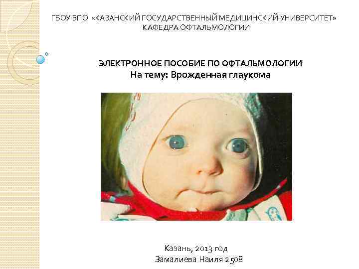 ГБОУ ВПО «КАЗАНСКИЙ ГОСУДАРСТВЕННЫЙ МЕДИЦИНСКИЙ УНИВЕРСИТЕТ» КАФЕДРА ОФТАЛЬМОЛОГИИ ЭЛЕКТРОННОЕ ПОСОБИЕ ПО ОФТАЛЬМОЛОГИИ На тему: