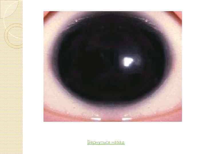 Вернуться назад 