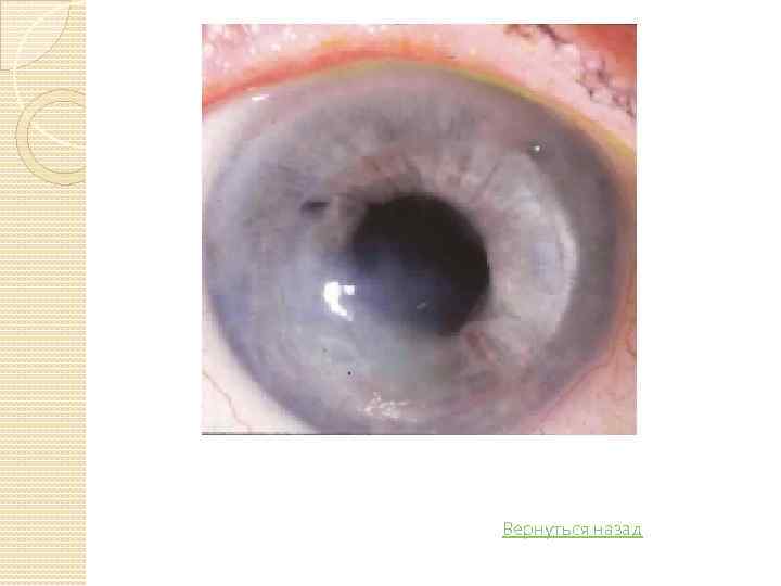 Вернуться назад 