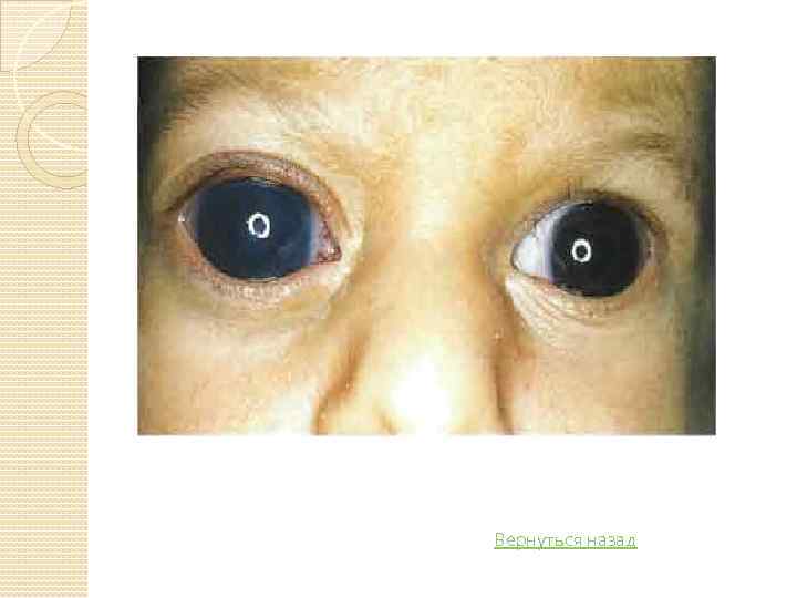 Вернуться назад 
