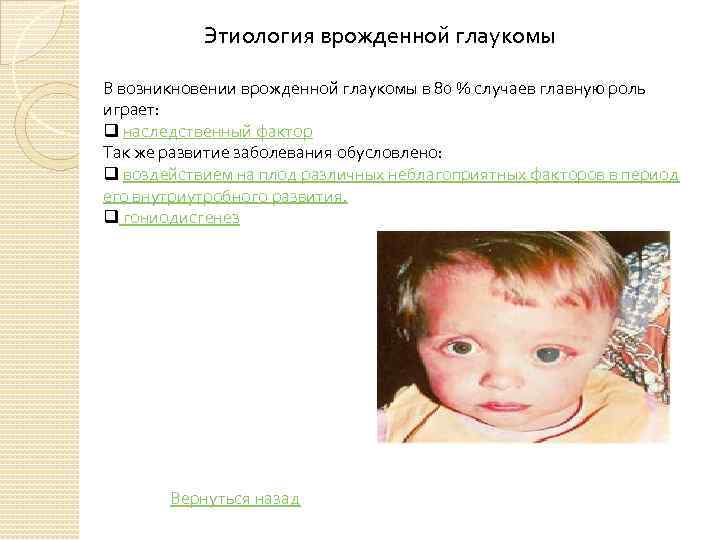 Этиология врожденной глаукомы В возникновении врожденной глаукомы в 80 % случаев главную роль играет:
