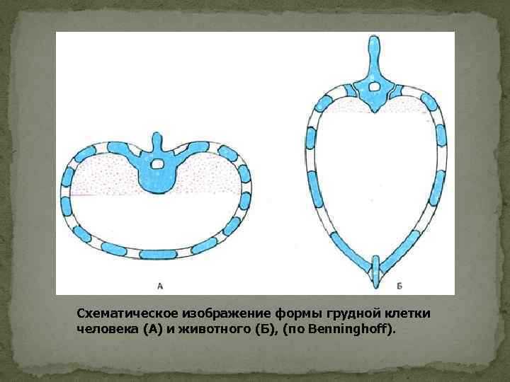 Схематическое изображение формы грудной клетки человека (А) и животного (Б), (по Benninghoff). 
