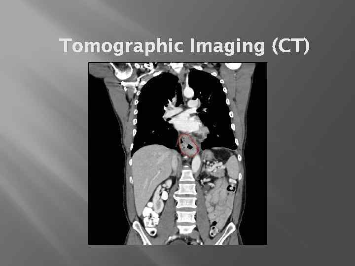 Tomographic Imaging (CT) 