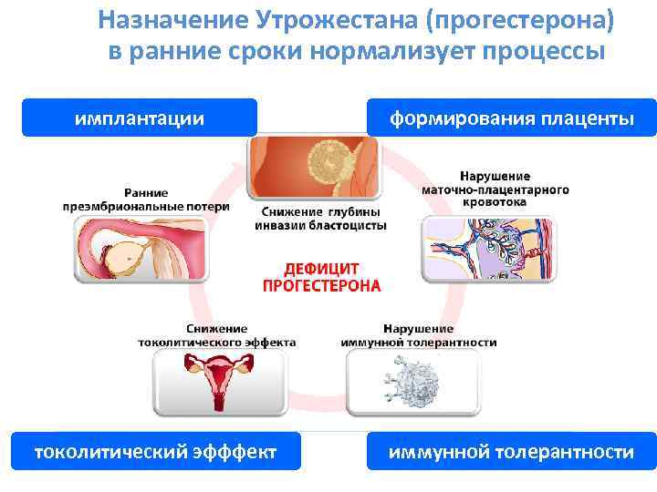 Назначение Утрожестана (прогестерона) в ранние сроки нормализует процессы имплантации токолитический эфффект формирования плаценты иммунной