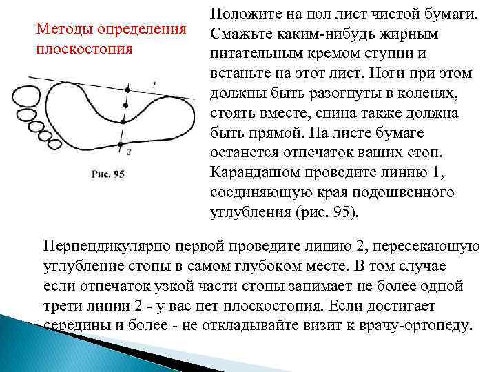 Выявление плоскостопия