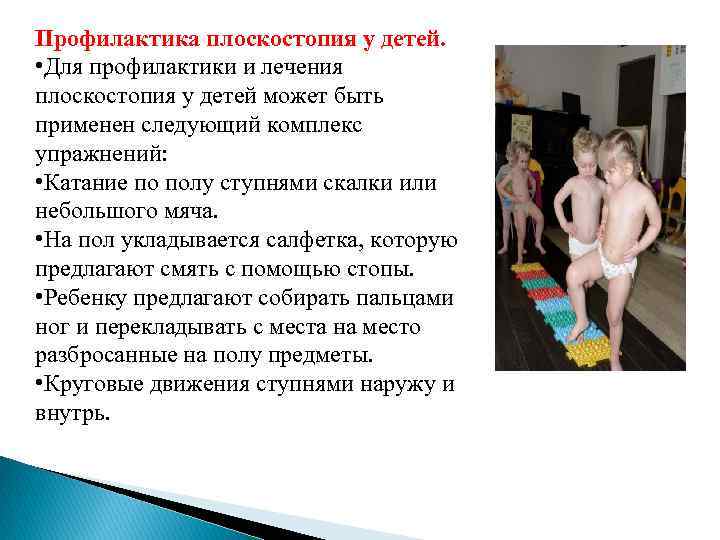 Профилактика плоскостопия у детей. • Для профилактики и лечения плоскостопия у детей может быть