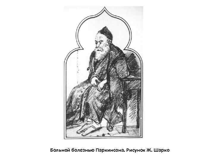 Больной болезнью Паркинсона. Рисунок Ж. Шарко 