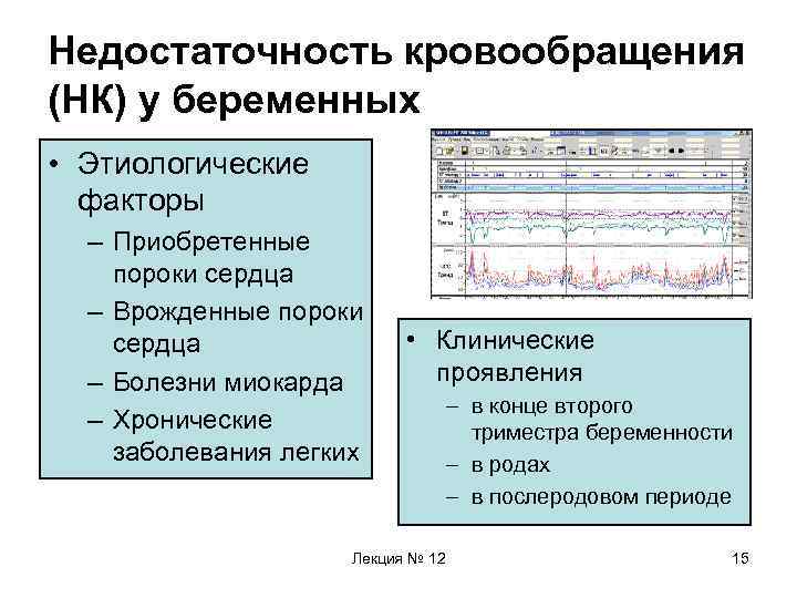 Недостаточность кровообращения (НК) у беременных • Этиологические факторы – Приобретенные пороки сердца – Врожденные