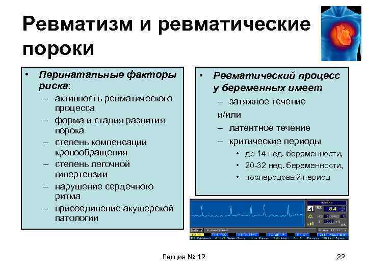 Ревматизм и ревматические пороки • Перинатальные факторы риска: – активность ревматического процесса – форма