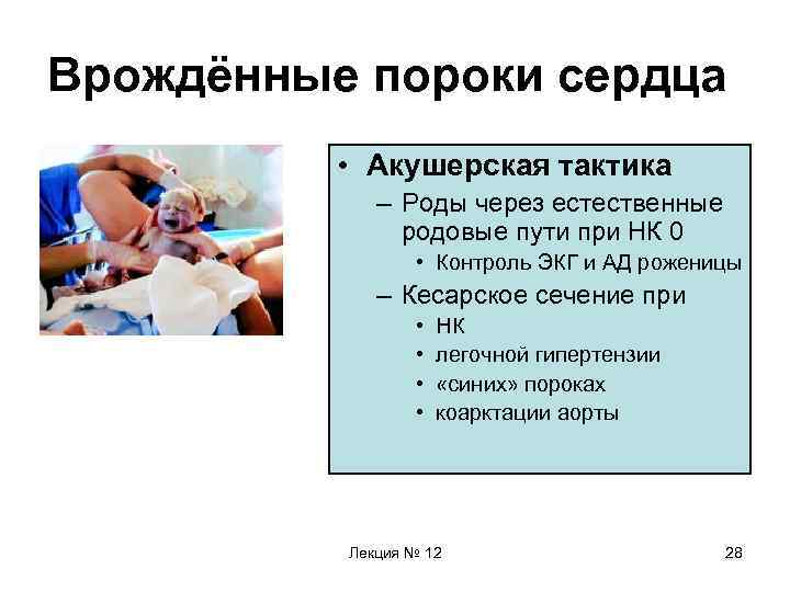 Врождённые пороки сердца • Акушерская тактика – Роды через естественные родовые пути при НК