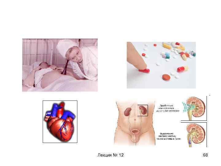 Лекция № 12 68 