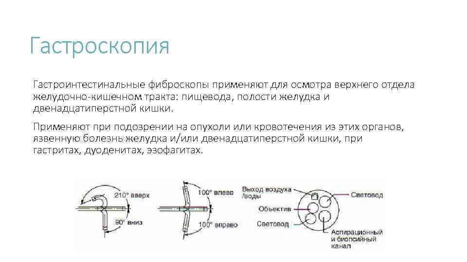 Гастроскопия Гастроинтестинальные фиброскопы применяют для осмотра верхнего отдела желудочно-кишечном тракта: пищевода, полости желудка и