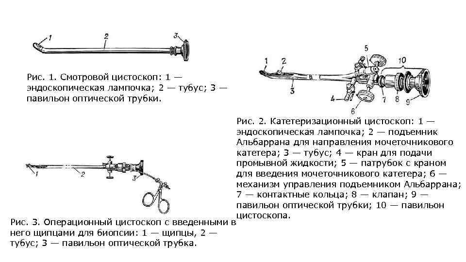 Рис. 1. Смотровой цистоскоп: 1 — эндоскопическая лампочка; 2 — тубус; 3 — павильон