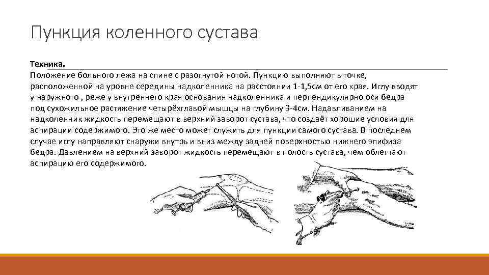 Пункция коленного сустава Техника. Положение больного лежа на спине с разогнутой ногой. Пункцию выполняют