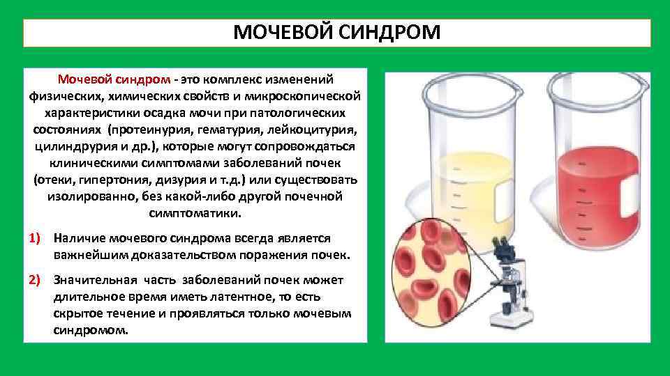 Мочевой синдром презентация