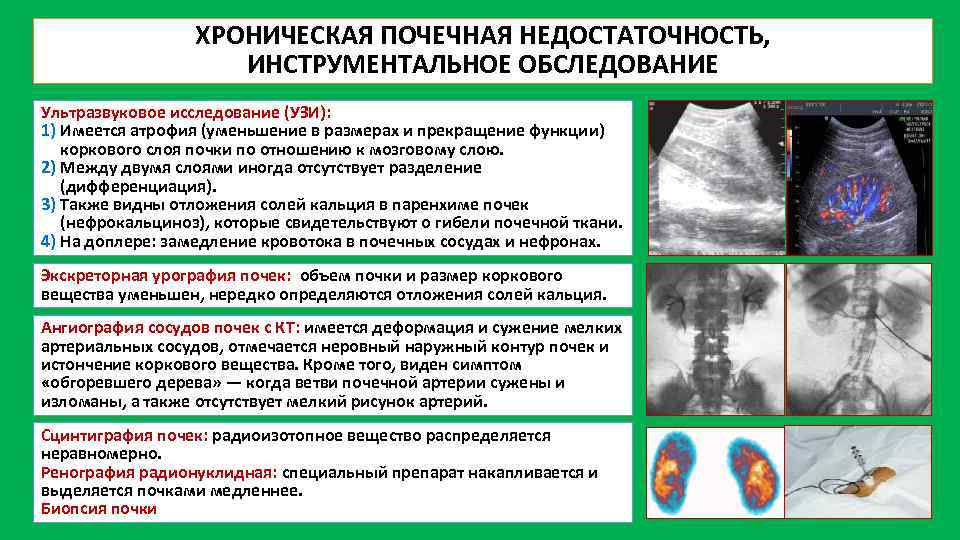 Диагностика хпн картинки