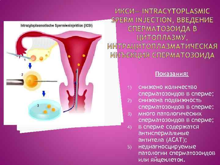 Показания: 1) 2) 3) 4) 5) снижено количество сперматозоидов в сперме; снижена подвижность сперматозоидов