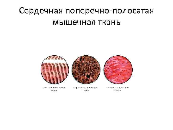 Сердечная поперечно-полосатая мышечная ткань 