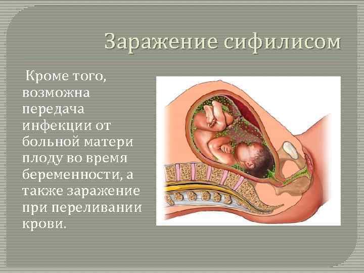 Заражение сифилисом Кроме того, возможна передача инфекции от больной матери плоду во время беременности,