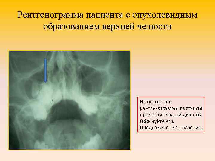 Диагностика новообразований челюстно лицевой области презентация