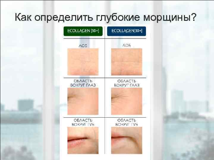 Как определить глубокие морщины? 