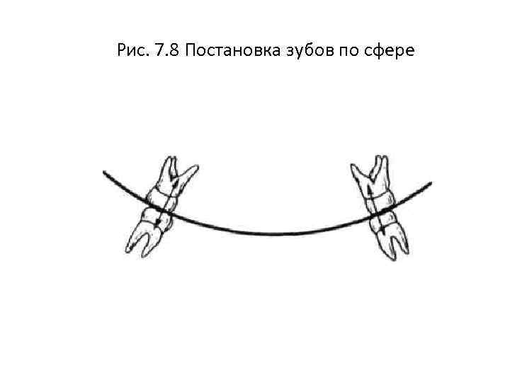 Постановка зубов по сферическим поверхностям презентация