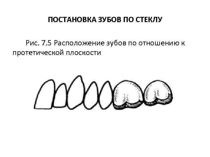 ПОСТАНОВКА ЗУБОВ ПО СТЕКЛУ Рис. 7. 5 Расположение зубов по отношению к протетической плоскости