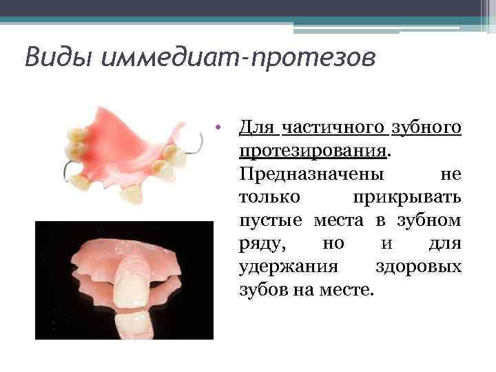 Виды иммедиат-протезов • Для частичного зубного протезирования. Предназначены не только прикрывать пустые места в