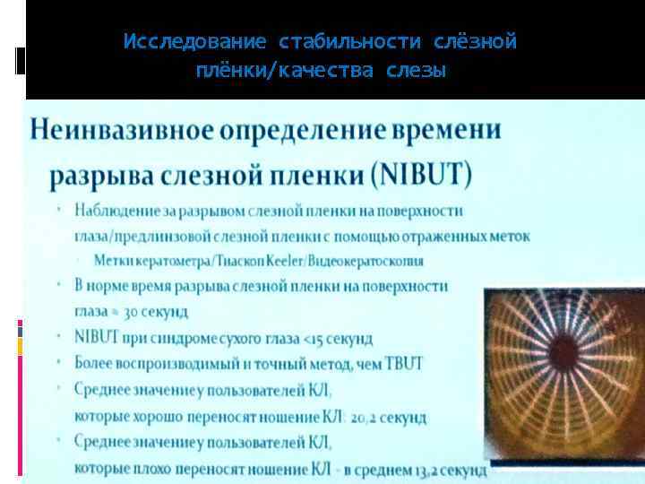 Исследование стабильности слёзной плёнки/качества слезы 