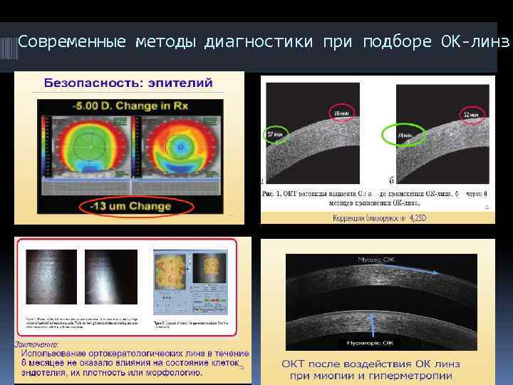 Современные методы диагностики при подборе ОК-линз 