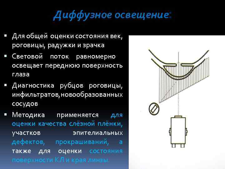 Диффузное освещение: Для общей оценки состояния век, роговицы, радужки и зрачка Световой поток равномерно