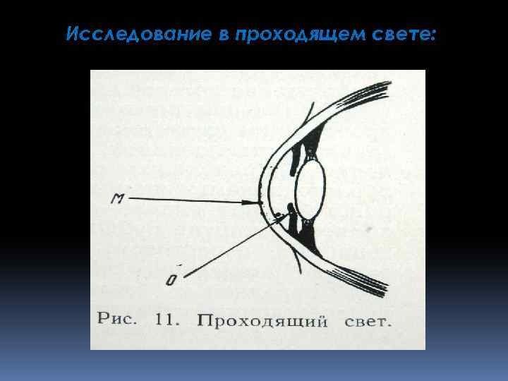 Исследование в проходящем свете: 