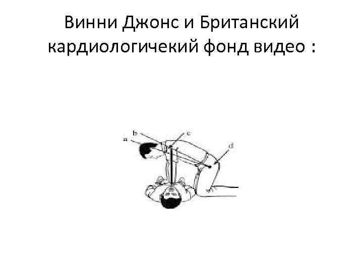 Винни Джонс и Британский кардиологичекий фонд видео : 