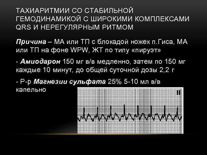 ТАХИАРИТМИИ СО СТАБИЛЬНОЙ ГЕМОДИНАМИКОЙ С ШИРОКИМИ КОМПЛЕКСАМИ QRS И НЕРЕГУЛЯРНЫМ РИТМОМ Причина – МА