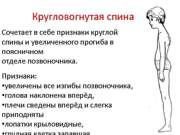 Круглая спина в год