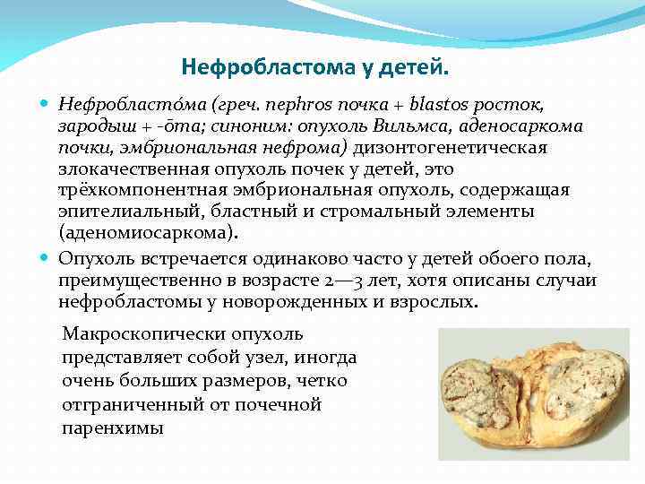 Нефробластома у детей. Нефробласто ма (греч. nephros почка + blastos росток, зародыш + -ōma;