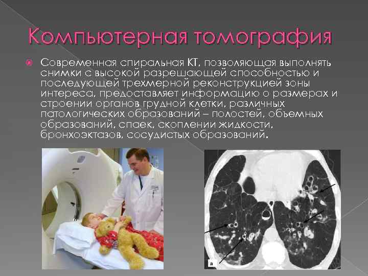 Компьютерная томография Современная спиральная КТ, позволяющая выполнять снимки с высокой разрешающей способностью и последующей