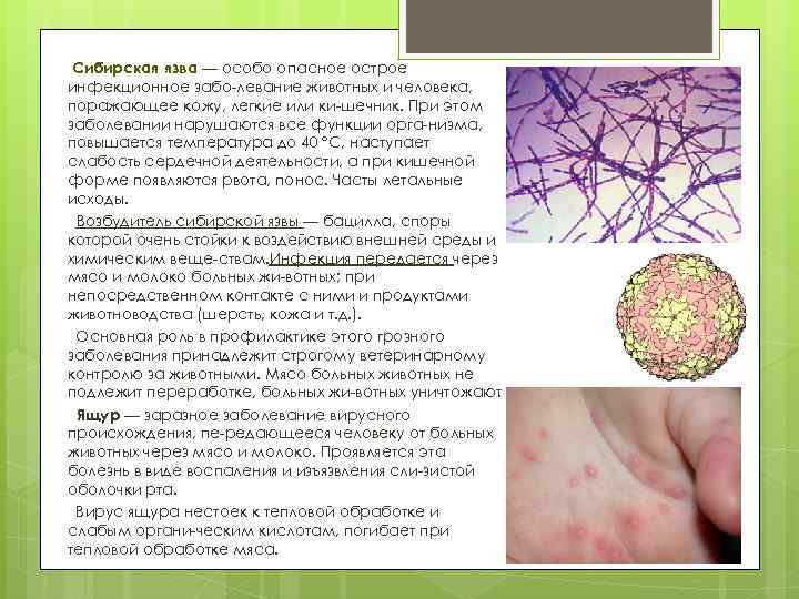 Сибирская язва — особо опасное острое инфекционное забо левание животных и человека, поражающее кожу,