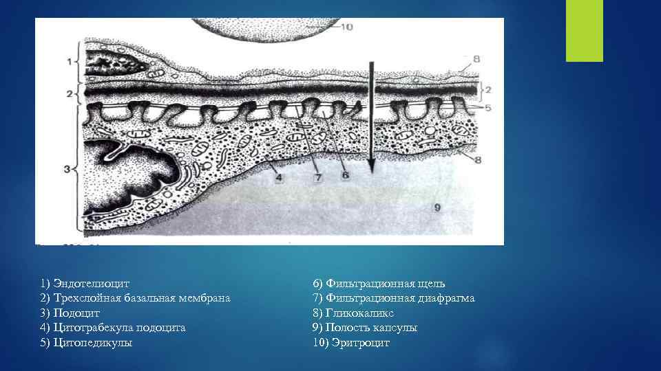 1) Эндотелиоцит 2) Трехслойная базальная мембрана 3) Подоцит 4) Цитотрабекула подоцита 5) Цитопедикулы 6)