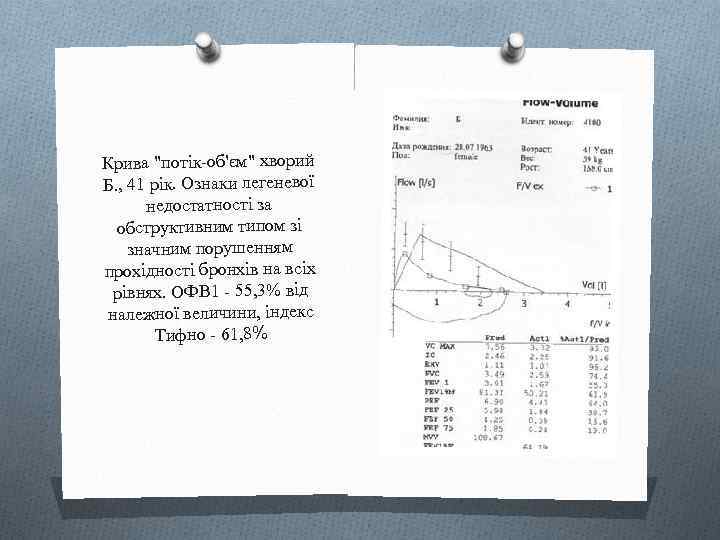 Крива "потік-об'єм" хворий Б. , 41 рік. Ознаки легеневої недостатності за обструктивним типом зі