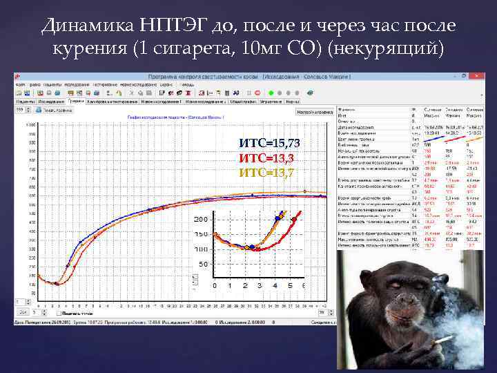 Динамика НПТЭГ до, после и через час после курения (1 сигарета, 10 мг СО)