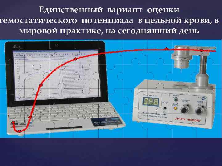 Единственный вариант оценки гемостатического потенциала в цельной крови, в мировой практике, на сегодняшний день