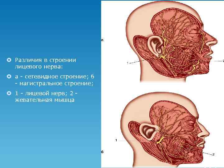 Лицевой нерв анатомия. Строение лицевого нерва. Магистральный и сетевидный Тип ветвления лицевого нерва в железе. Сетевидное образование.