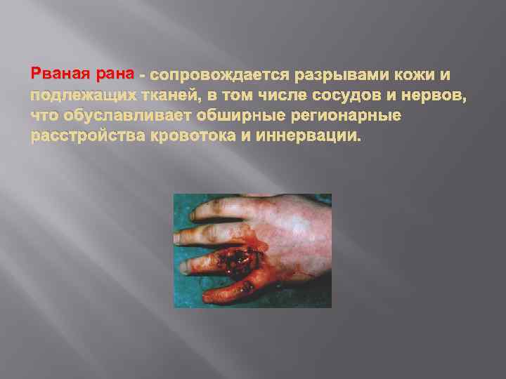 Рваная рана - сопровождается разрывами кожи и подлежащих тканей, в том числе сосудов и