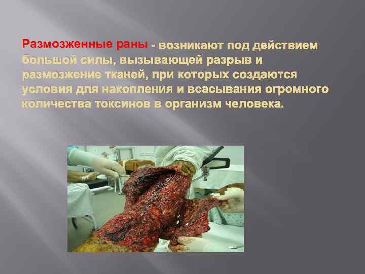 Размозженные раны - возникают под действием большой силы, вызывающей разрыв и размозжение тканей, при