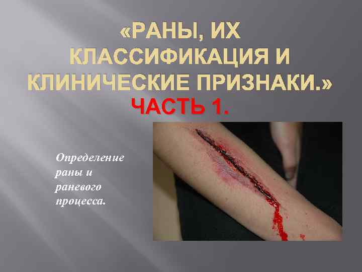  «РАНЫ, ИХ КЛАССИФИКАЦИЯ И КЛИНИЧЕСКИЕ ПРИЗНАКИ. » ЧАСТЬ 1. Определение раны и раневого