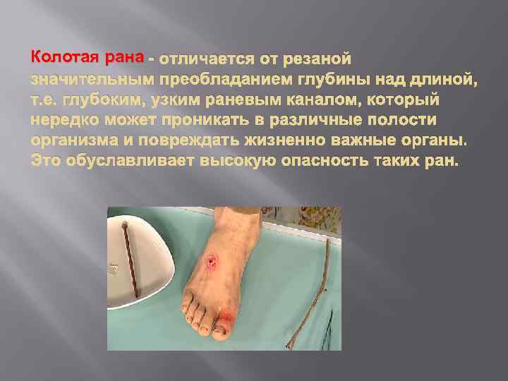 Колотая рана - отличается от резаной значительным преобладанием глубины над длиной, т. е. глубоким,