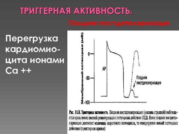 ТРИГГЕРНАЯ АКТИВНОСТЬ. Поздняя постдеполяризация Перегрузка кардиомиоцита ионами Са ++ 